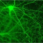 mch-neurons-hypothalamus