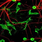 microglia-and-neurons