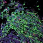 neurons-from-cord-blood-cells