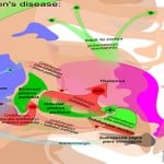 parkinsons-disease-diagram