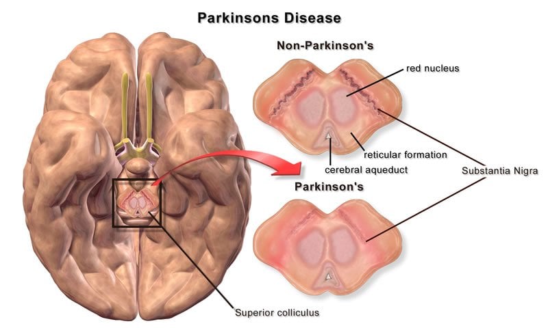 acute stroke order sets