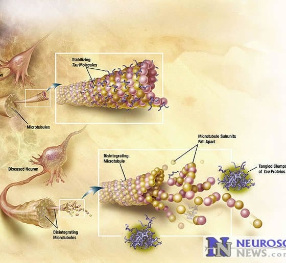 How Alzheimer's Protein Tangles Spread Through the Brain Neuroscience