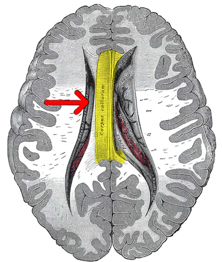 crosstalk-between-left-and-right-hemisphere-is-key-to-language