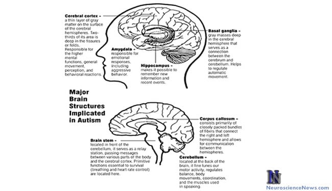 The image shows the major brain structures implicated in autism.