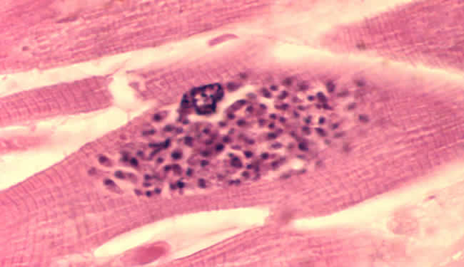 toxoplasmosis gondii brain