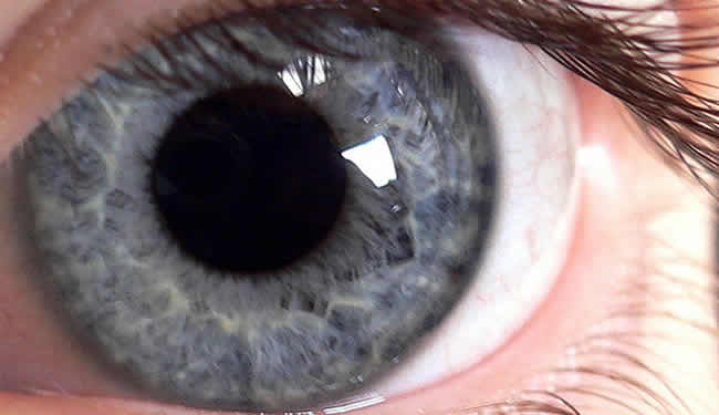 An eyeball is shown.