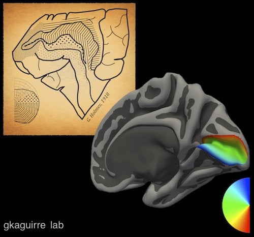 A brain image is next to a drawing of a 1918 brain map.