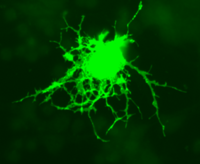 The image shows an oligodendrocyte transfected with GFP (Green Fluorescent Protein).