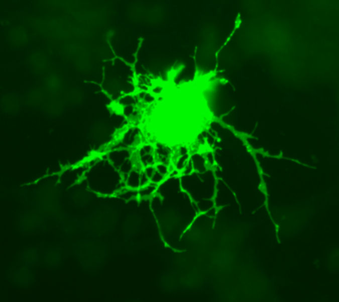 The image shows an oligodendrocyte transfected with GFP (Green Fluorescent Protein).