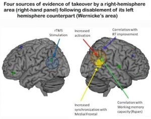 Two brain images are shown side by side with Wernicke's area highlighted.