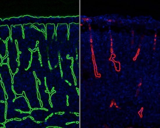 The image shows two slides of blood vessels.