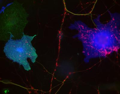 The image shows neurons expressing neuroglobin-2 and MDGA1. The caption explains the image best.