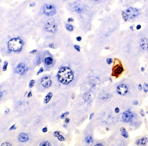 The image shows a section of mouse liver showing an apoptotic cell.