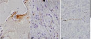 Image shows brain slices with deposits of proteins associated with Alzheimer's and Parkinson's disease.