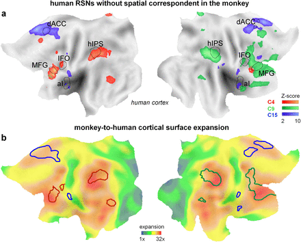 the image shows different fmri scans of the cerebral cortex.