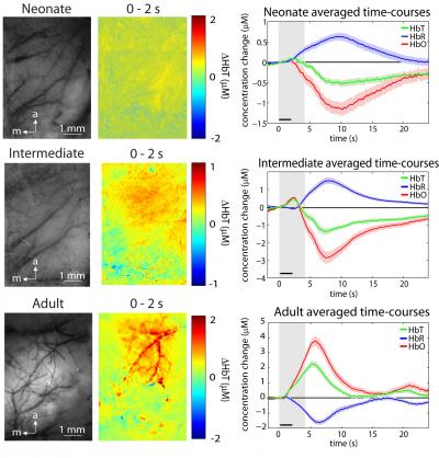 The image shows the MS-OISI images of the cortical surface. The caption best explains the image.