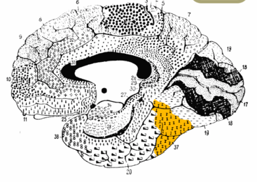 The brain diagram shown highlights the fusiform gyrus (Brodmann area 37), which is associated with FFA.