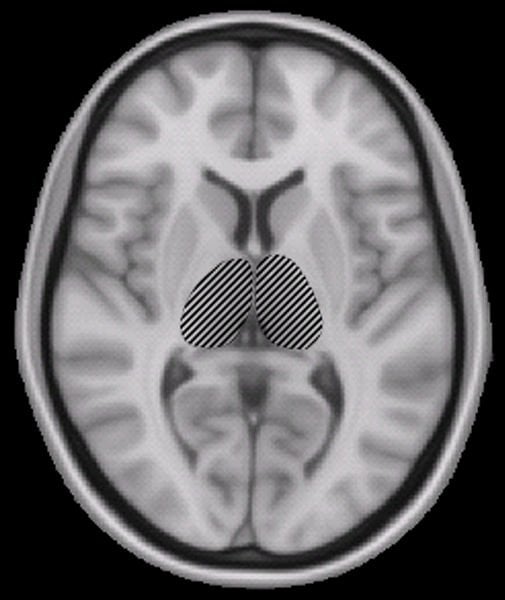 The image shows a brain scan with the thalamus highlighted.