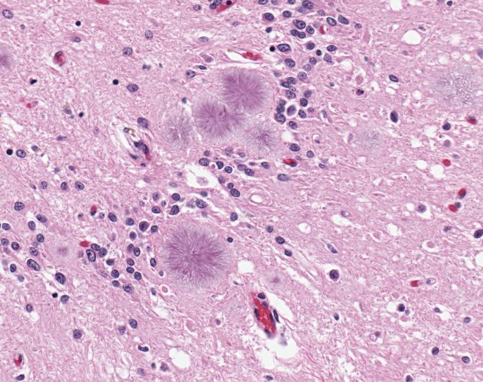 The image shows a brain slice with amyloid plaques stained.
