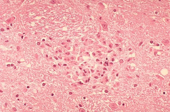 The image shows microglial cells in a brain slice.