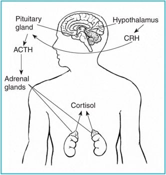 The diagram shows how adrenocorticotropin hormone is secreted in Cushing's disease.