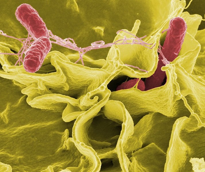 The image shows Salmonella typhimurium invading cultured human cells.