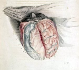This illustration shows an open skull exposing the brain of a sleeping man.
