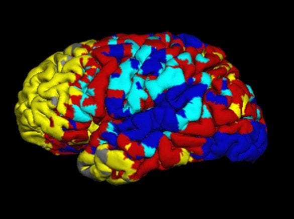 This is an fMRI of the brain during resting state.