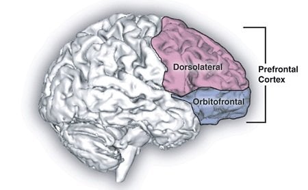 This is a diagram of the prefronal cortex.