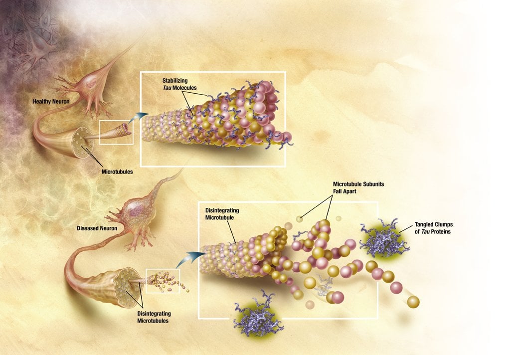 The image shows the tau proteins associated with Alzheimer's disease.