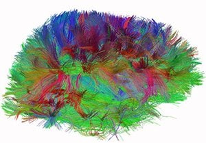 The image shows a mapped brain. The caption best describes the image.
