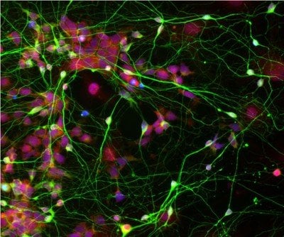 The image shows human neuronal stem cells. The caption best describes the image.