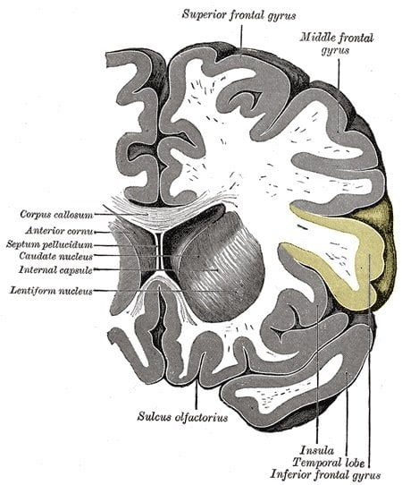 The inferior frontal gyrus is highlighted in yellow in this brain image.