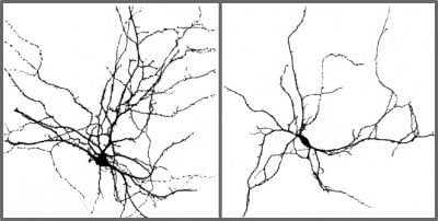 This is an image of the interneurons discussed in the research. The caption best describes the image.