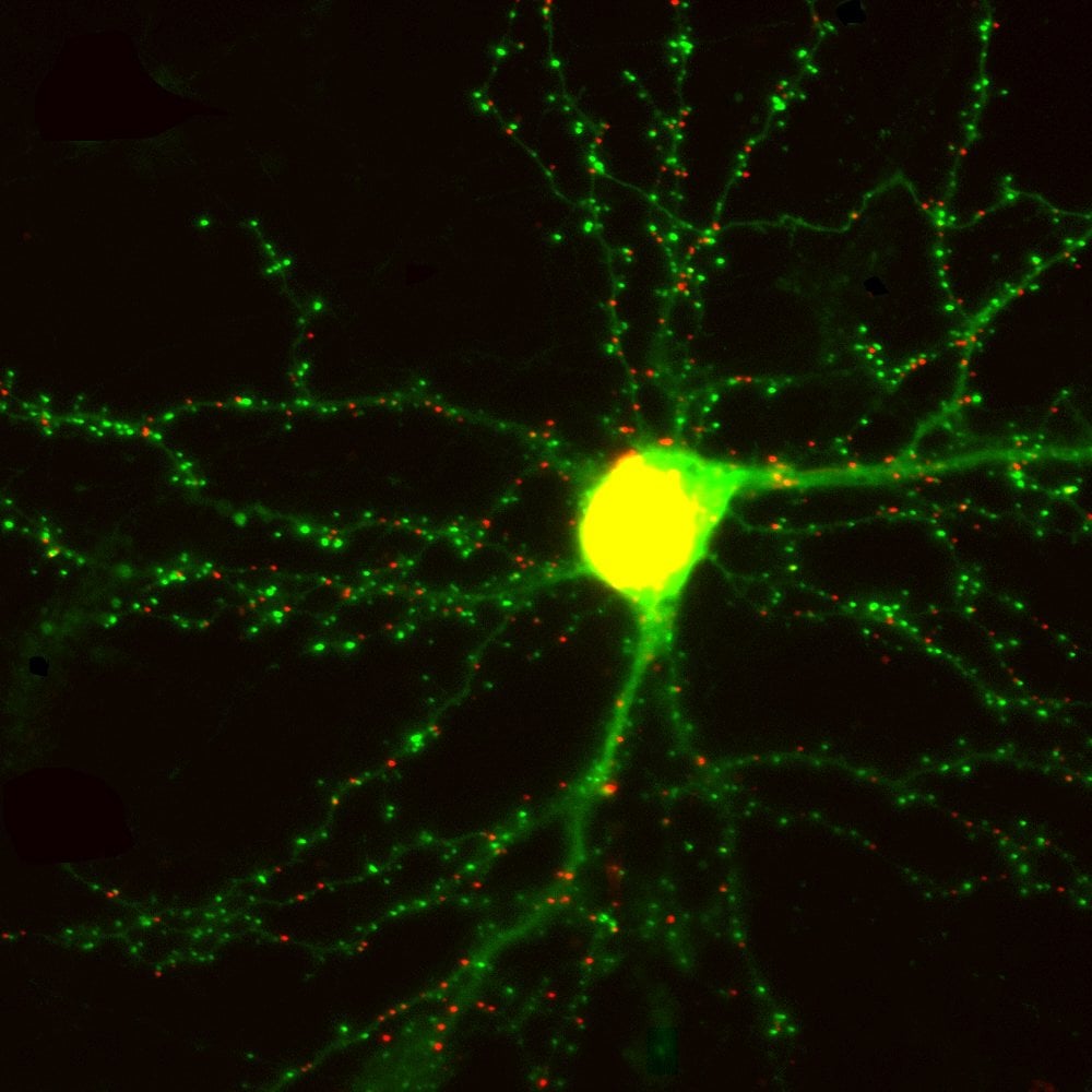 This is an image of a living neuron.