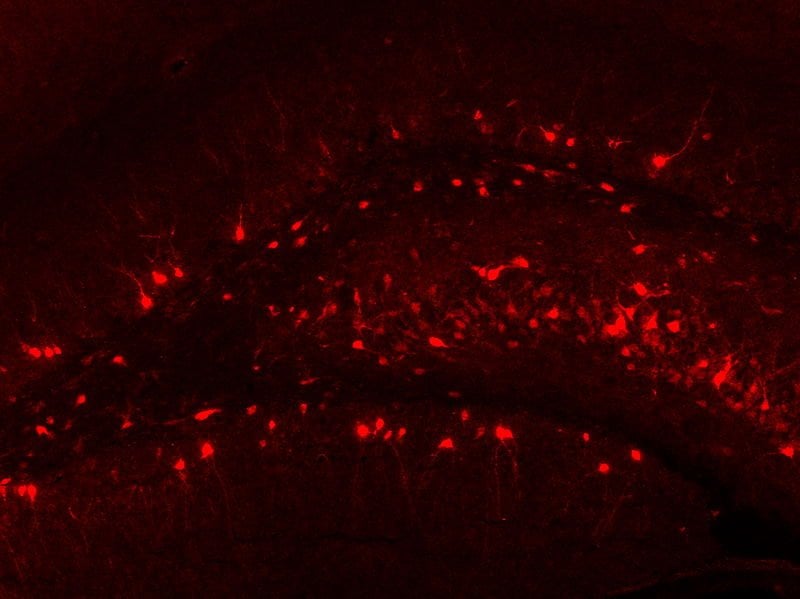 The image shows Arc immunohistochemical staining of the rat (Rattus norvegicus) dentate gyrus..