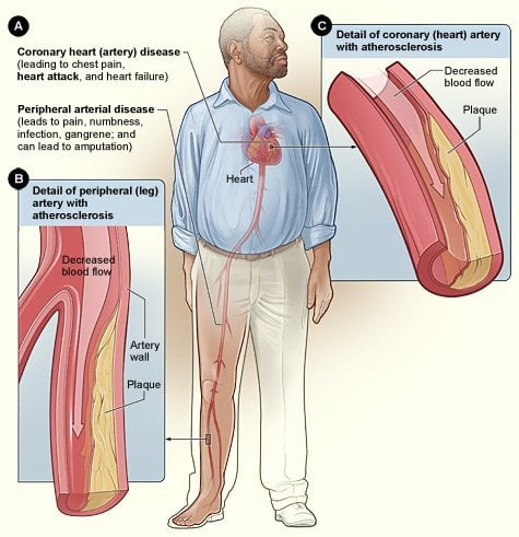 The image shows the effects of smoking on the body.