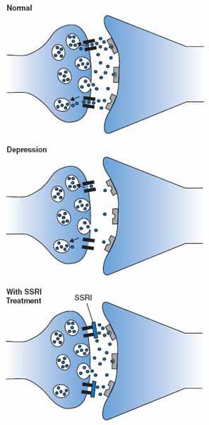 The image shows how neurons function with SSRIs.