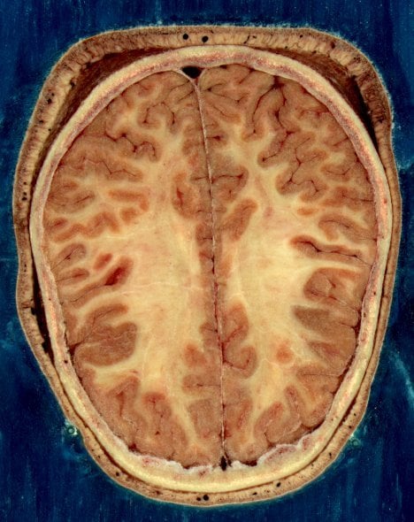 This is a horizontal slice of the head of an adult female.