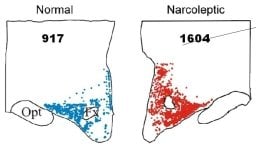 The image shows the different number of histamine cells in narcoleptics compared to those without the disorder.