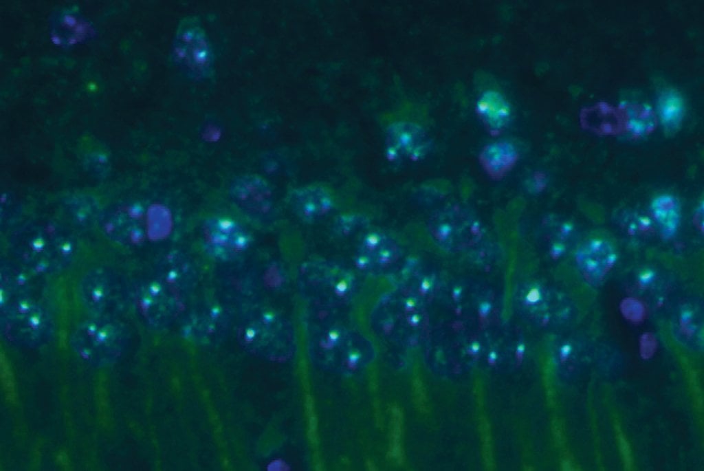 The image shows prefoldin protein expression in mice.