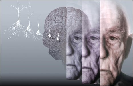 This image shows the brain of an older man, along with an image of an elderly male.