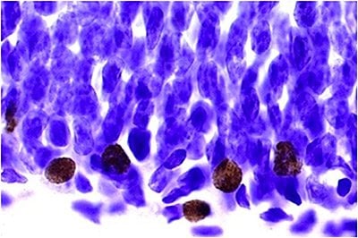 This electrophysiology image shows the impact running has on new neurons in the hippocampus.