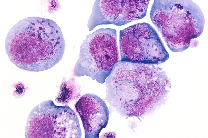 This is a histological slide of the human herpes virus-6.