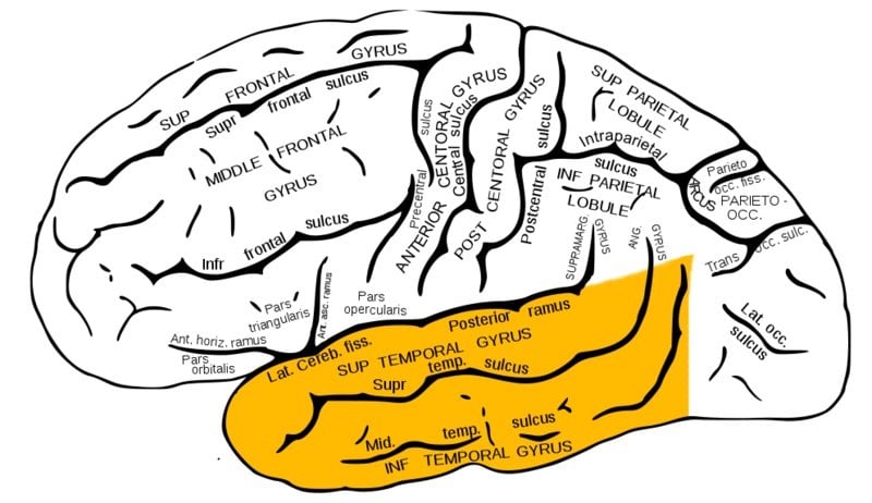 The brain diagram highlights the temporal lobe in yellow.