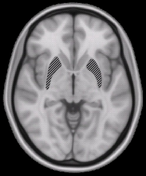 This brain scan shows the location of the putamen in the brain.