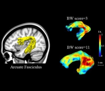 This is an image of the brain scans taken for this study.