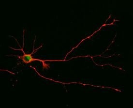 The image shows a neuron and axon.