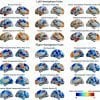 The image shows the hemispheric lateralization maps for the hubs of the brain. The caption best describes the image.