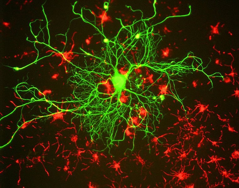 This illustrative image shows cortical neuron stained with antibody to neurofilament subunit NF-L in green. In red are neuronal stem cells stained with antibody to alpha-internexin.